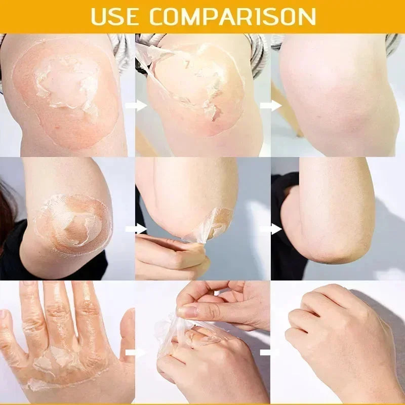 EELHOE Vitamin C & Hyaluronic Acid Body Peeling Lotion – Exfoliating & Brightening Skin Renewal Treatment (100ml)