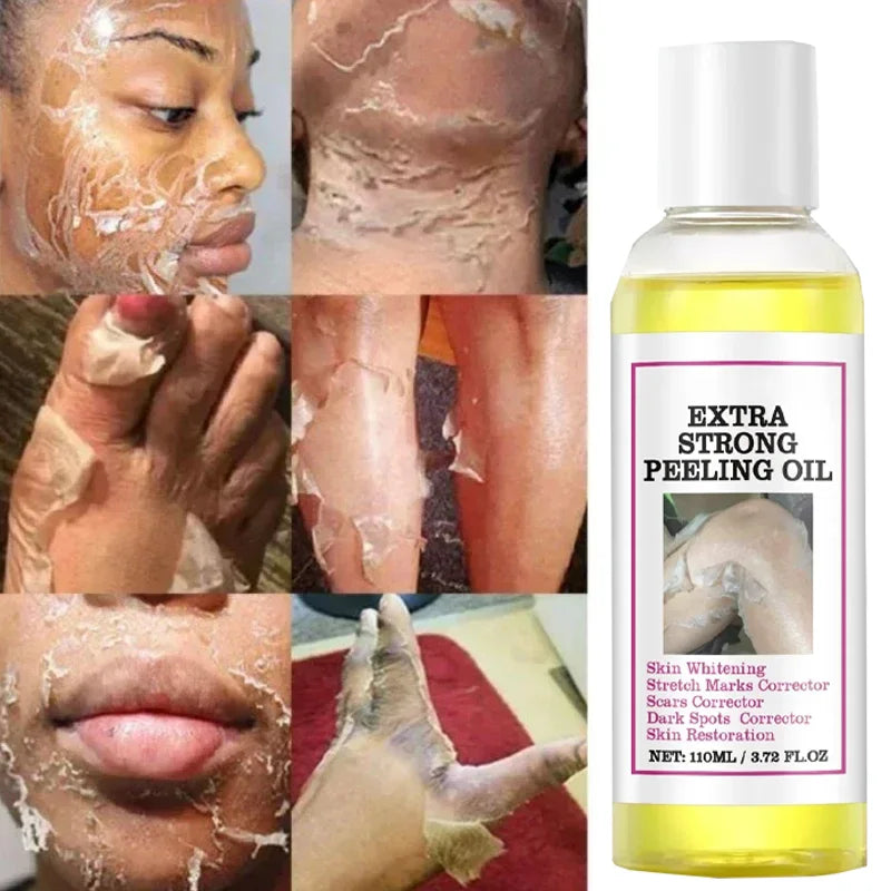 EELHOE Vitamin C & Hyaluronic Acid Body Peeling Lotion – Exfoliating & Brightening Skin Renewal Treatment (100ml)