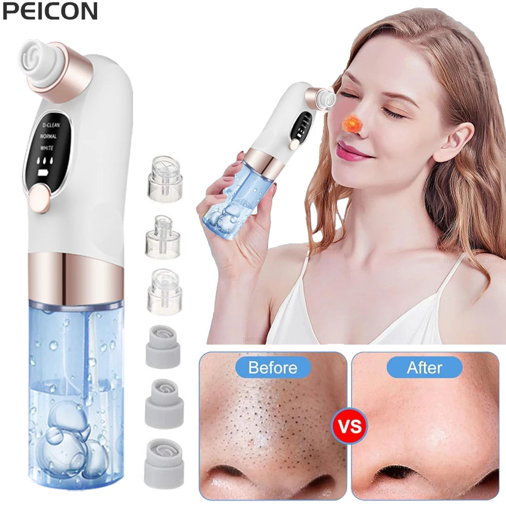 Peicon Electric Blackhead Remover Pore Vacuum – EMS Deep Cleansing | Rechargeable Facial Cleaner
