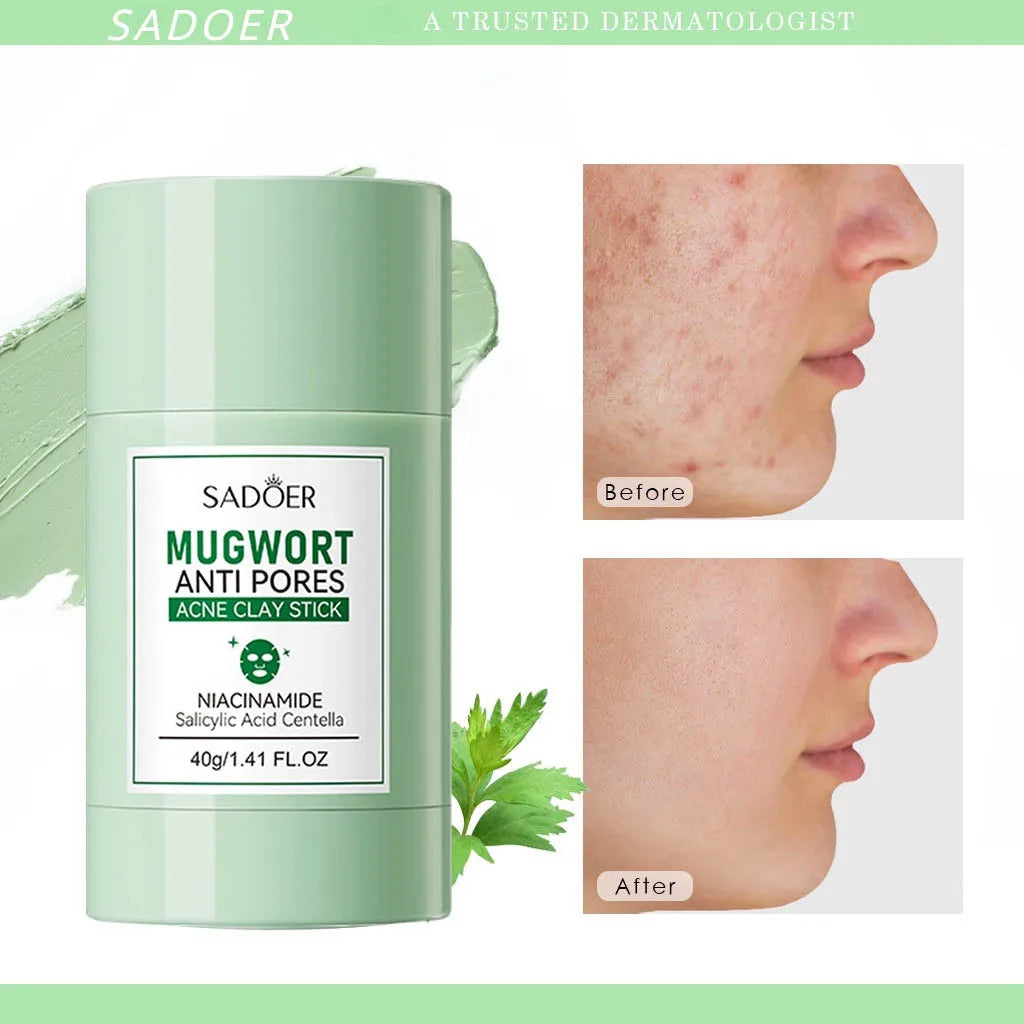 SADOER Deep Cleansing Mud Mask – Vitamin C & Mugwort | Acne Treatment & Oil Control 40g