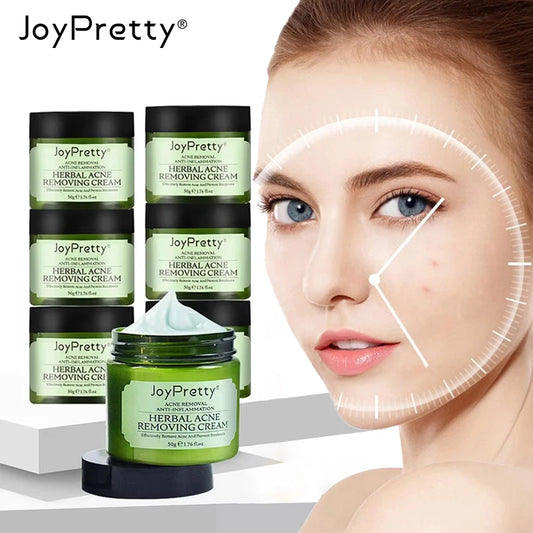 Blackhead Remover & Pore Minimizing Face Cream