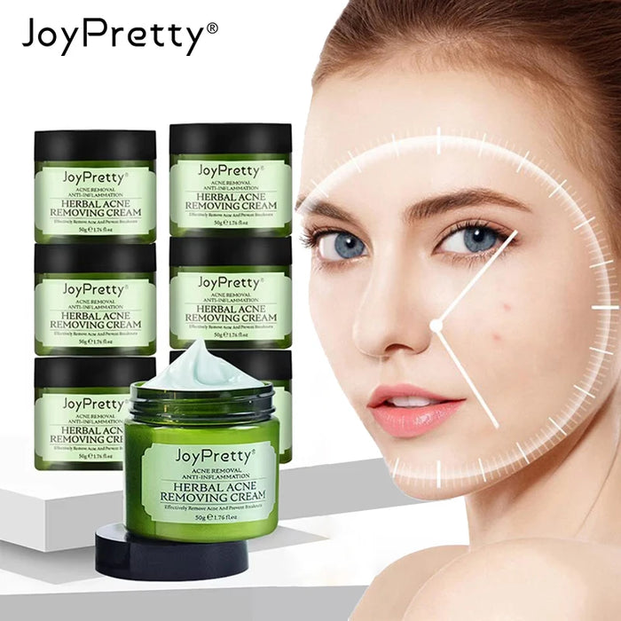 Blackhead Remover & Pore Minimizing Face Cream