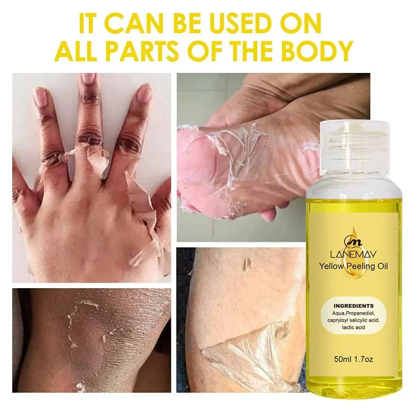 EELHOE Yellow Peeling Oil – Exfoliating Body Serum for Dark Spots, Knees, Elbows & Uneven Skin Tone (30ml / 50ml / 100ml)