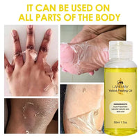 EELHOE Yellow Peeling Oil – Exfoliating Body Serum for Dark Spots, Knees, Elbows & Uneven Skin Tone (30ml / 50ml / 100ml)