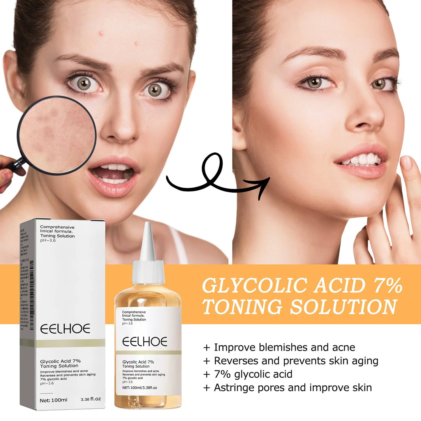 EELHOE Glycolic Acid 7% Toner – Exfoliating & Pore-Minimizing Face Toner for Clear, Glowing Skin (100ml)