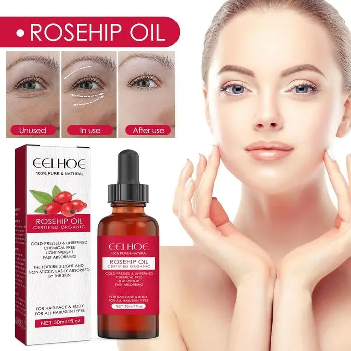 Rosehip Seed Oil Serum – Scars & Stretch Marks