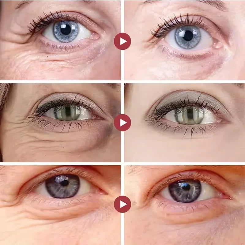 Collagen & Hyaluronic Acid Eye Patches — Firming, Anti Dark Circles & Eye Bag Treatment
