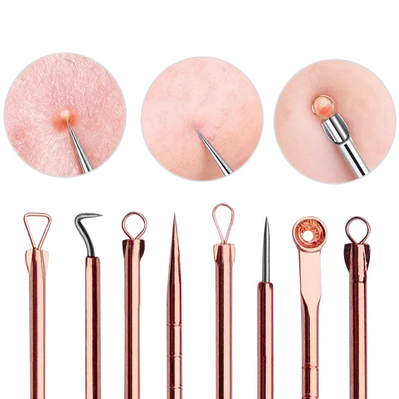 YJYIBEI Ultra-Fine Acne & Blackhead Extractor Set – 4-Piece Facial Pore Cleanser