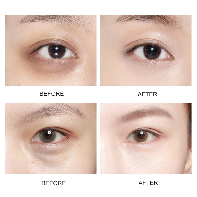 Crystal Gold Collagen Eye Patches – Anti Dark Circles, Puffiness & Moisturizing