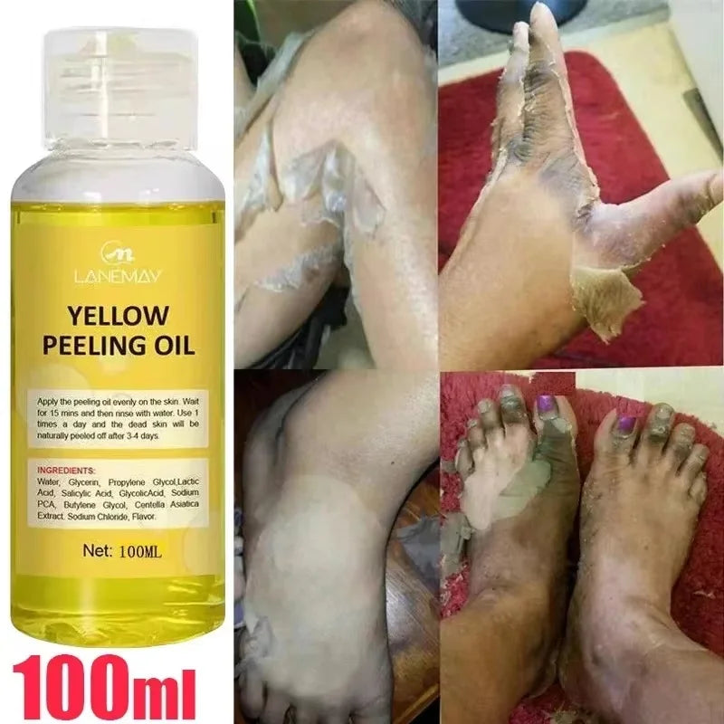 EELHOE Yellow Peeling Oil – Exfoliating Body Serum for Dark Spots, Knees, Elbows & Uneven Skin Tone (30ml / 50ml / 100ml)