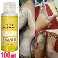 EELHOE Yellow Peeling Oil – Exfoliating Body Serum for Dark Spots, Knees, Elbows & Uneven Skin Tone (30ml / 50ml / 100ml)