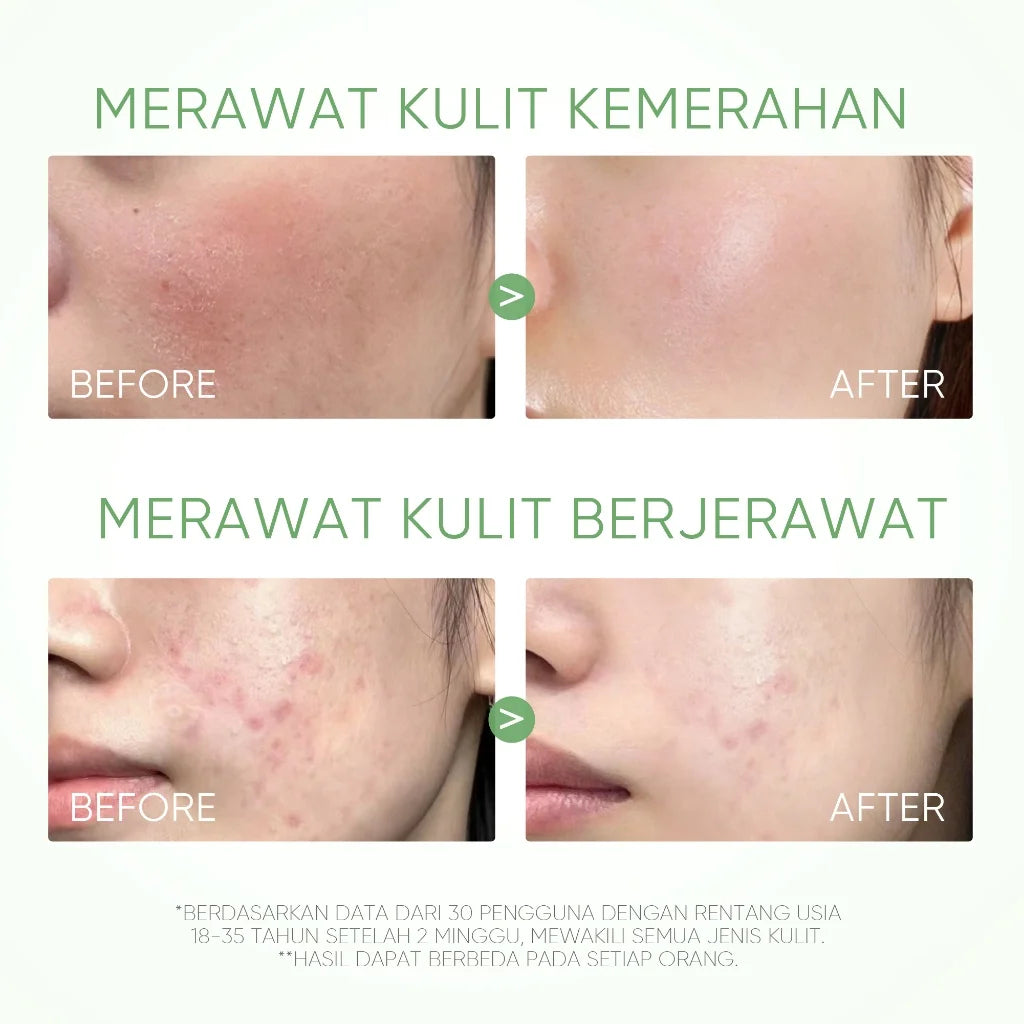 SADOER Deep Cleansing Mud Mask – Vitamin C & Mugwort | Acne Treatment & Oil Control 40g