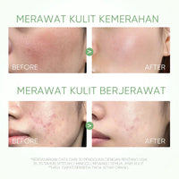 SADOER Deep Cleansing Mud Mask – Vitamin C & Mugwort | Acne Treatment & Oil Control 40g