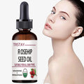 5ML/15ML/30ML/50ML/Pure Essential Oils Rosehip Oil Moisturizing Brighten Skin Color Essential Oil Anti-Dry Anti-Aging Face Essen