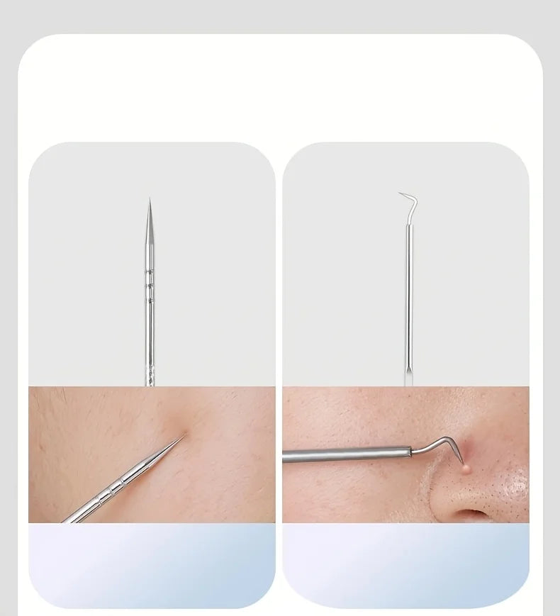 YJYIBEI Stainless Steel Acne Removal Tool Set – Blackhead & Pimple Popper Kit | 4, 7 or 8pcs