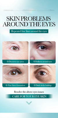 BIOAQUA Crystal Collagen Eye Mask Patches – 80 Pieces, Dark Circles & Anti-Aging