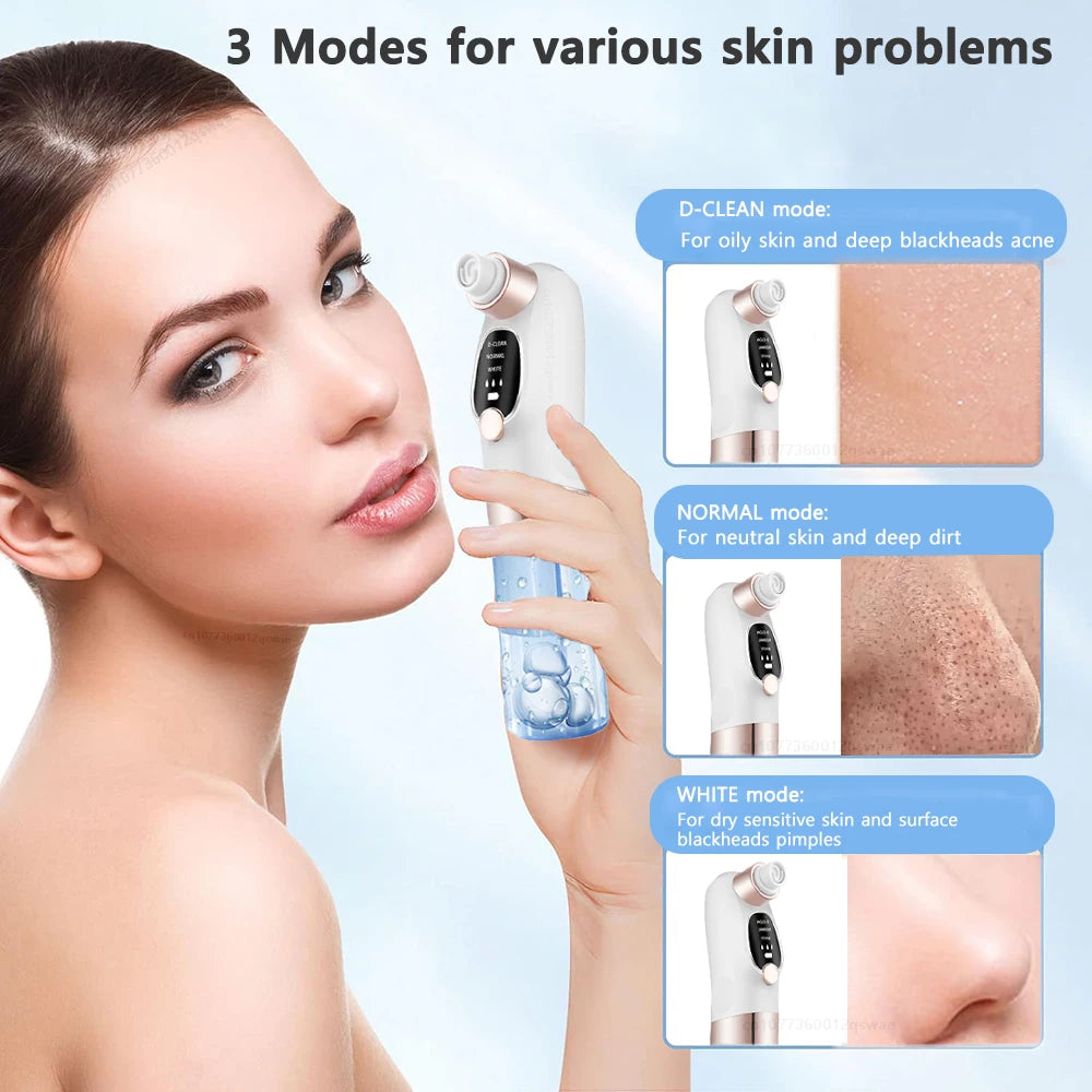 BXA Electric Blackhead Remover Pore Vacuum – Water Cycle Deep Cleansing | USB Rechargeable