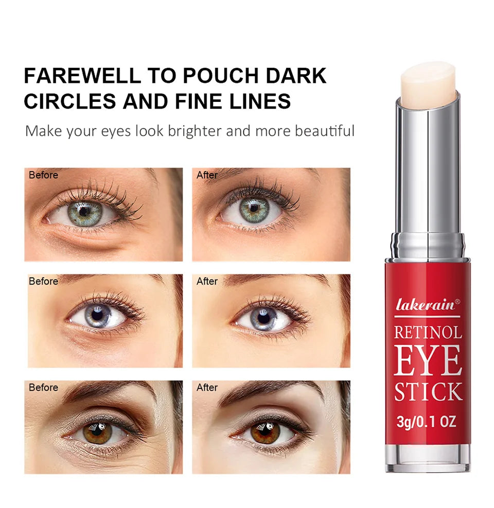 Retinol Eye Cream Stick – Anti-Aging Dark Circle & Firming Eye Balm for Puffiness, Fine Lines & Brightening (3g)