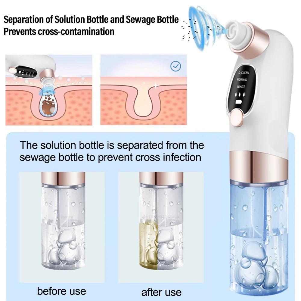 Peicon Electric Blackhead Remover Pore Vacuum – EMS Deep Cleansing | Rechargeable Facial Cleaner