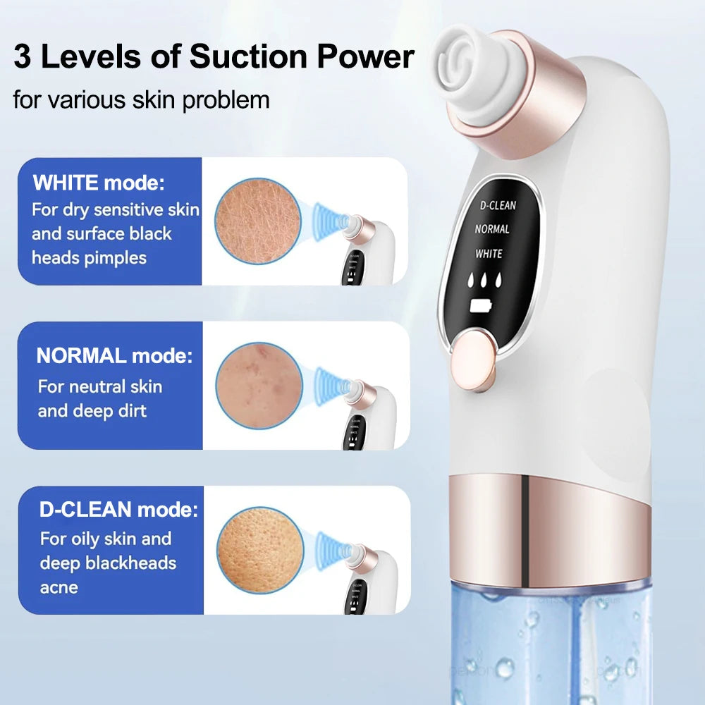 Peicon Electric Blackhead Remover Pore Vacuum – EMS Deep Cleansing | Rechargeable Facial Cleaner