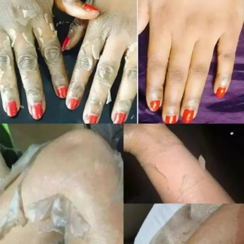 EELHOE Yellow Peeling Oil – Exfoliating Body Serum for Dark Spots, Knees, Elbows & Uneven Skin Tone (30ml / 50ml / 100ml)