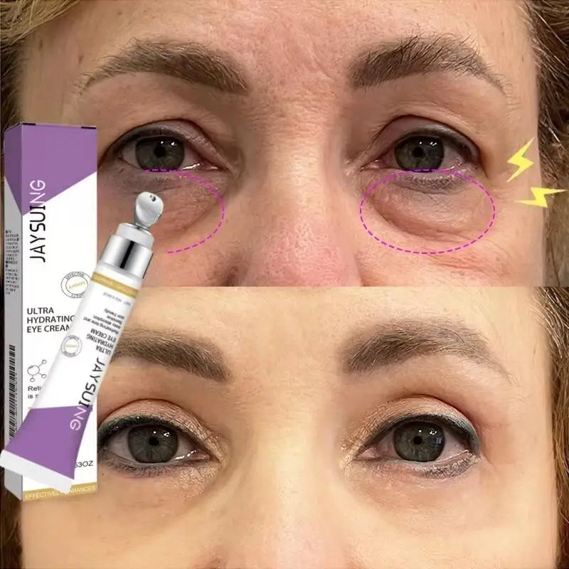 LAIKOU Retinol Eye Cream – Anti-Wrinkle, Dark Circle & Eye Bag Removal, 15g