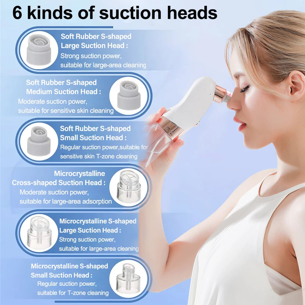 Peicon Electric Blackhead Remover Pore Vacuum – EMS Deep Cleansing | Rechargeable Facial Cleaner