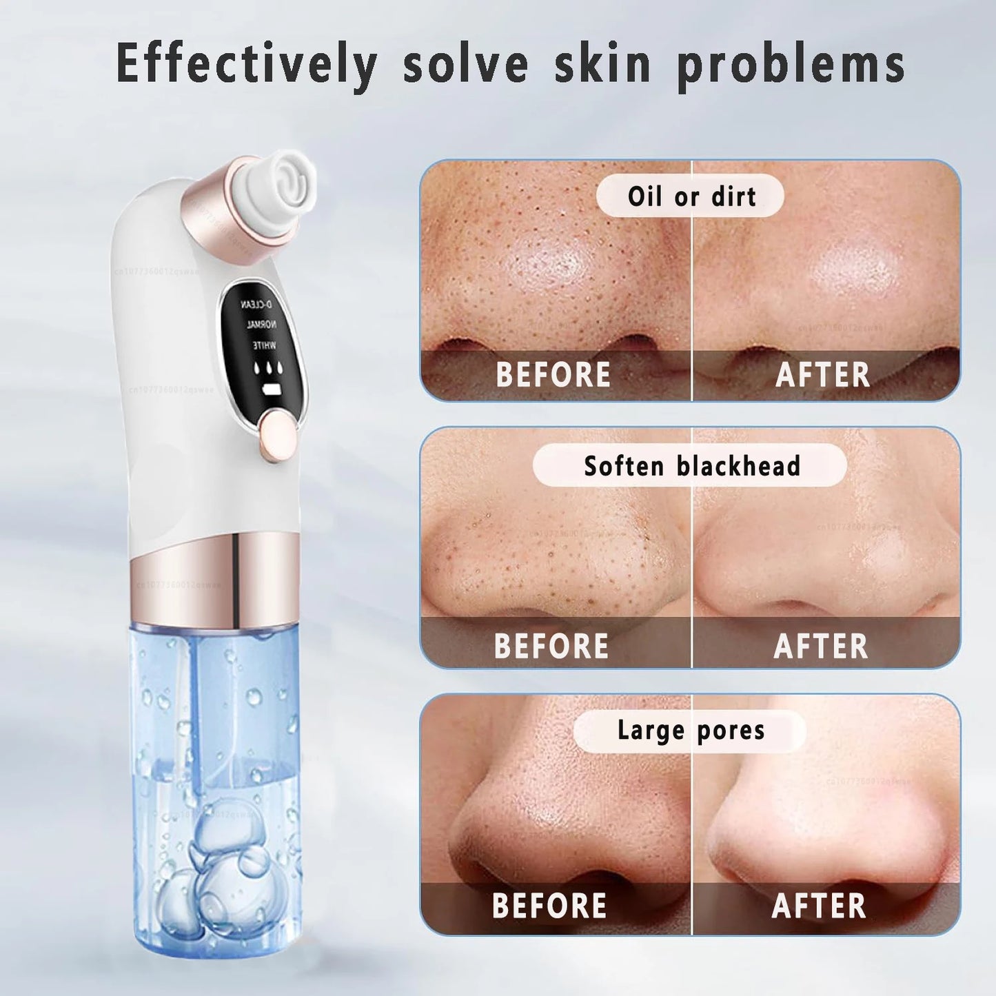 BXA Electric Blackhead Remover Pore Vacuum – Water Cycle Deep Cleansing | USB Rechargeable