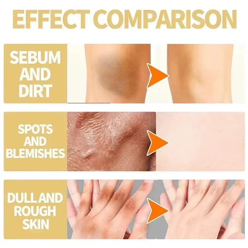 EELHOE Yellow Peeling Oil – Exfoliating Body Serum for Dark Spots, Knees, Elbows & Uneven Skin Tone (30ml / 50ml / 100ml)
