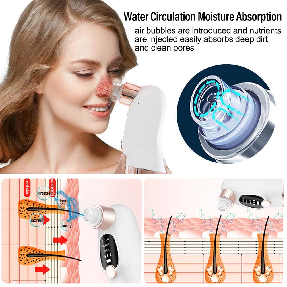 Peicon Electric Blackhead Remover Pore Vacuum – EMS Deep Cleansing | Rechargeable Facial Cleaner