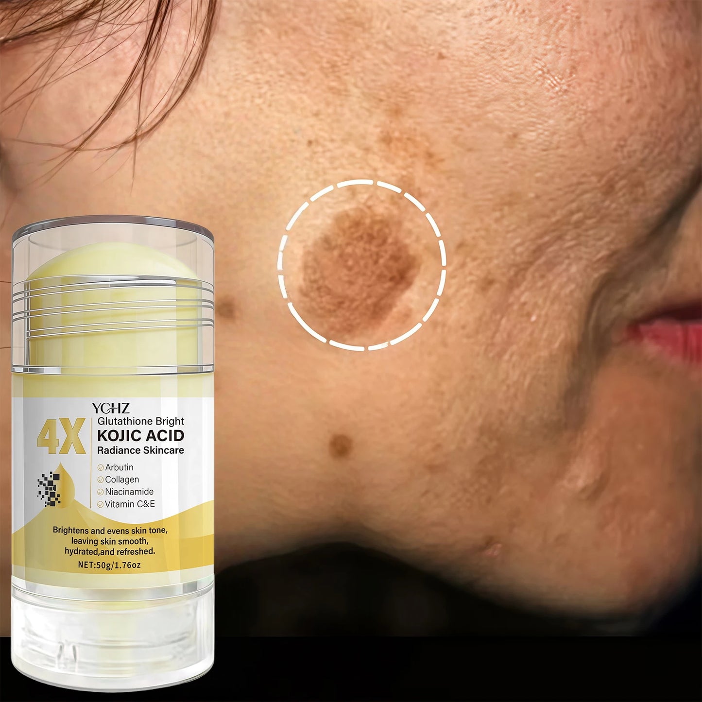 Kojic Acid Whitening Cream Stick – Dark Spot Corrector & Skin Tone Evener for Men & Women (50g)