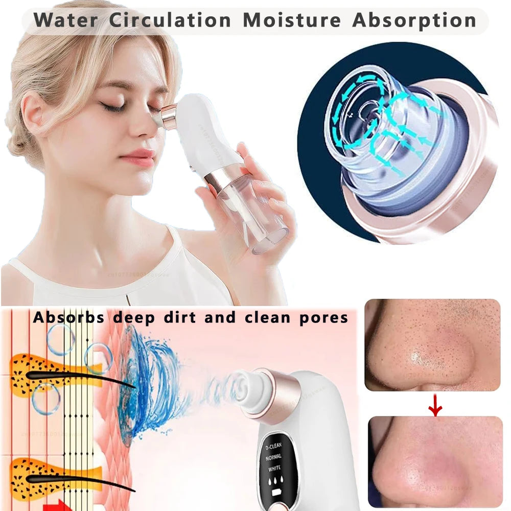 BXA Electric Blackhead Remover Pore Vacuum – Water Cycle Deep Cleansing | USB Rechargeable