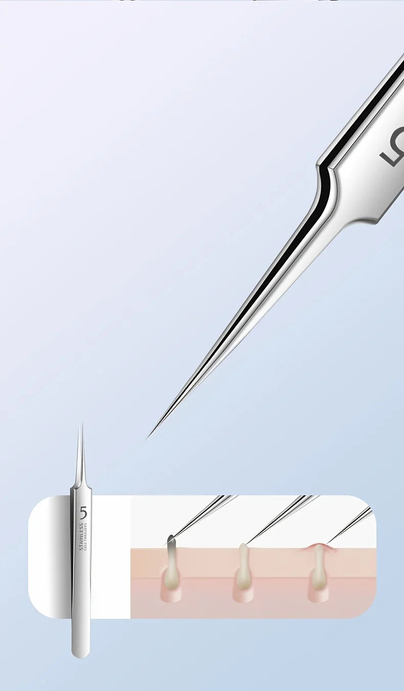 YJYIBEI Stainless Steel Acne Removal Tool Set – Blackhead & Pimple Popper Kit | 4, 7 or 8pcs