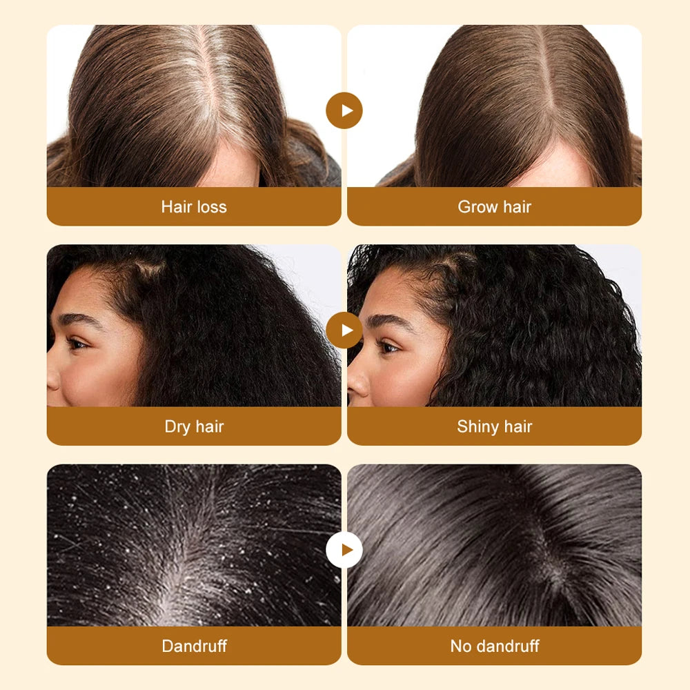 Organic Batana Oil Hair Care – Hair Growth Oil (50ml)