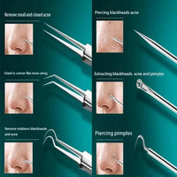 11-Piece Blackhead & Ingrown Hair Removal Tool Set – Acne Needles, Pore Cleaner & Tweezers Kit