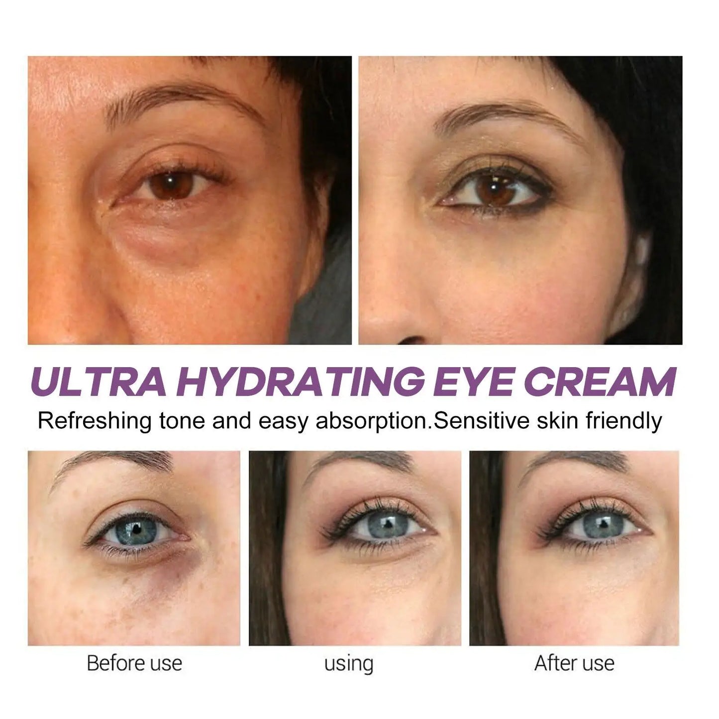 LAIKOU Retinol Eye Cream – Anti-Wrinkle, Dark Circle & Eye Bag Removal, 15g