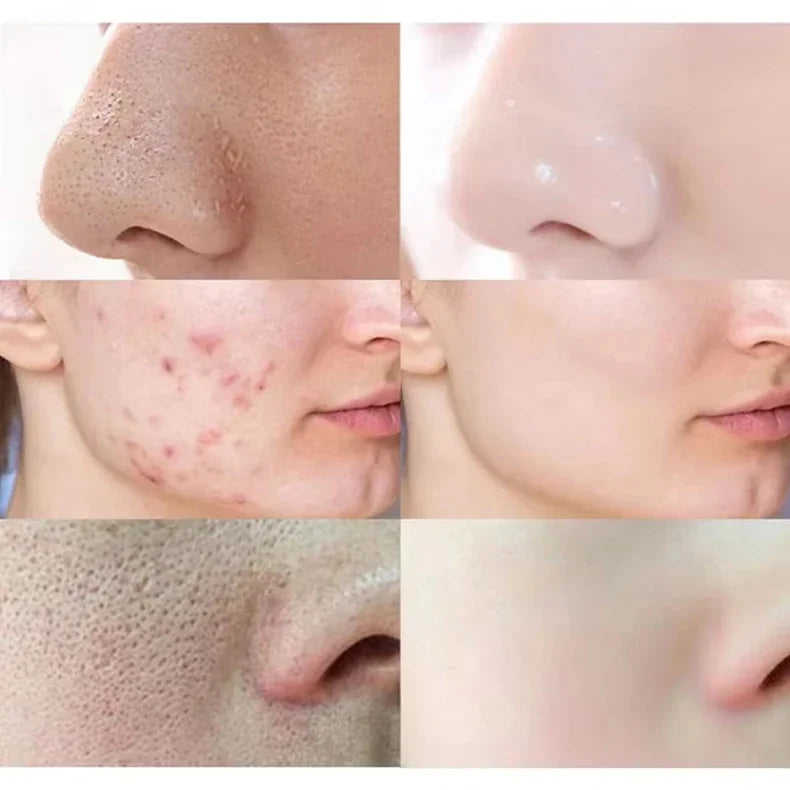 Jaysuing Cleansing Mask Stick – Mugwort, Alaska Volcano & More | Pore Minimizer & Acne Treatment 40g