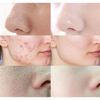 Jaysuing Cleansing Mask Stick – Mugwort, Alaska Volcano & More | Pore Minimizer & Acne Treatment 40g