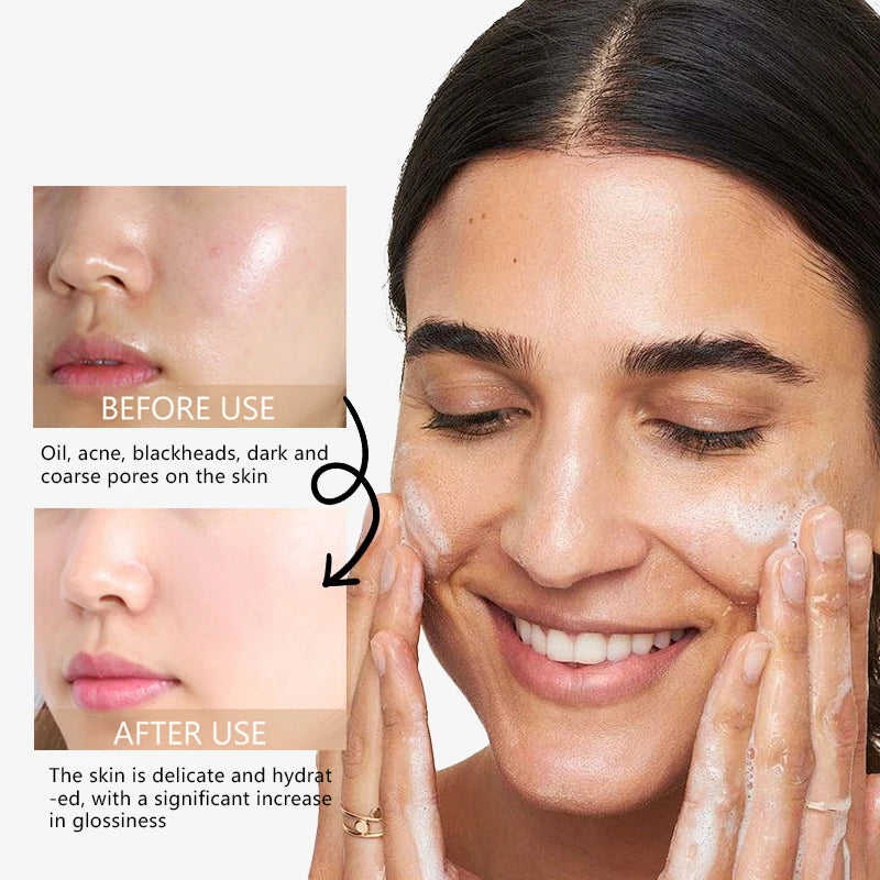 RAVE LADY Low pH Amino Acid Facial Cleanser – Oil Control, Exfoliating & Moisturizing Face Wash (150ml)