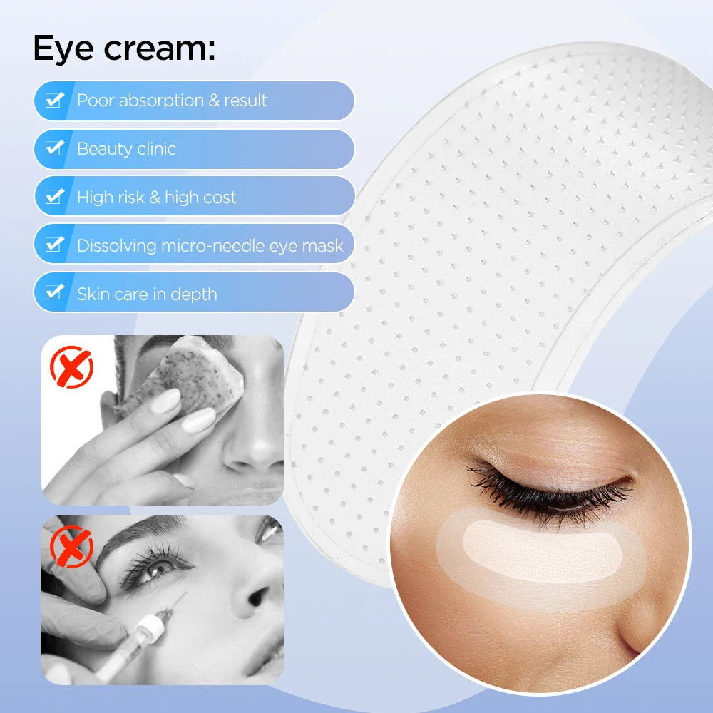 Microneedle Eye Patches with Hyaluronic Acid — Anti Dark Circles, Wrinkles & Fine Lines