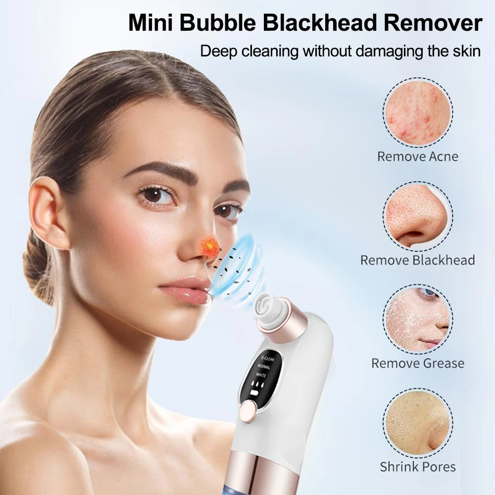 Peicon Electric Blackhead Remover Pore Vacuum – EMS Deep Cleansing | Rechargeable Facial Cleaner
